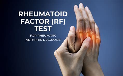 example of a positive id rf on human|rheumatoid arthritis rf.